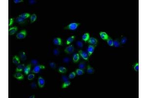 Immunofluorescence staining of Hela cells with ABIN7158282 at 1:100, counter-stained with DAPI. (CD47 anticorps  (AA 44-141))