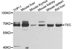 Western blot analysis of extracts of various cell lines, using TEC antibody. (NR4A3 anticorps  (AA 1-280))