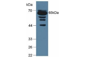 Figure. (C9 anticorps  (AA 136-512))