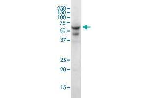 CRAT polyclonal antibody (A01).