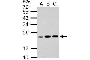 WB Image Sample (30 ug of whole cell lysate) A: Jurkat B: Raji C: K562 12% SDS PAGE antibody diluted at 1:1000 (RPL17P7 anticorps  (Center))