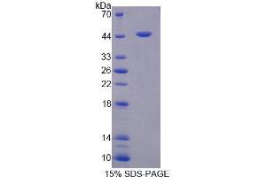 SDS-PAGE (SDS) image for Fasciculation and Elongation Protein zeta 2 (Zygin II) (FEZ2) (AA 1-375) protein (His tag) (ABIN6239388) (FEZ2 Protein (AA 1-375) (His tag))