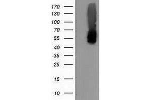 Western Blotting (WB) image for anti-Calcium Binding and Coiled-Coil Domain 2 (CALCOCO2) antibody (ABIN1497075) (CALCOCO2 anticorps)