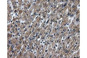 Immunohistochemical staining of paraffin-embedded liver tissue using anti-RALBP1mouse monoclonal antibody. (RALBP1 anticorps)