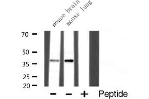 Western blot analysis of Synaptophysin expression in various lysates (Synaptophysin anticorps  (Internal Region))