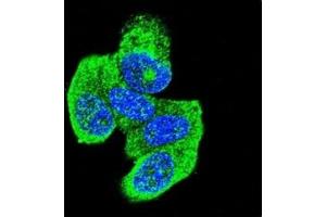 Confocal immunofluorescent analysis of H-RAS antibody with MCF-7 cells followed by Alexa Fluor 488-conjugated goat anti-rabbit lgG (green).