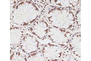 Immunohistochemistry of paraffin-embedded Human colon using Phospho-PRKAA1(T183)/PRKAA2(T172) Polyclonal Antibody at dilution of 1:100 (40x lens).