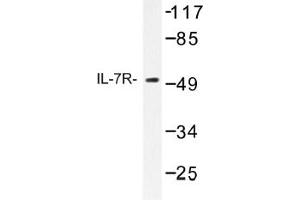Image no. 1 for anti-Interleukin 7 Receptor (IL7R) antibody (ABIN317658) (IL7R anticorps)
