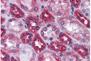 Human Kidney: Formalin-Fixed, Paraffin-Embedded (FFPE) (Calnexin anticorps  (AA 204-218))