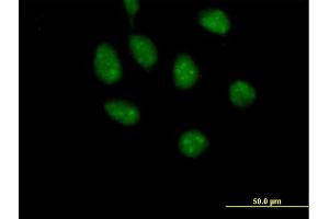 Immunofluorescence of purified MaxPab antibody to GATAD2B on HeLa cell. (GATAD2B anticorps  (AA 1-593))