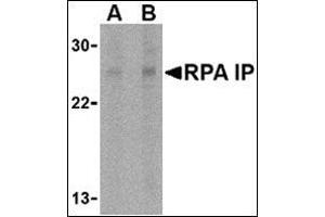 Western blot analysis of RPA Interacting Protein in Jurkat cell lysate with this product at (A) 1 and (B) 2 μg/ml. (RPAIN anticorps  (C-Term))