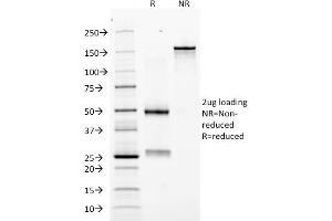 SDS-PAGE Analysis Purified Erythropoietin Mouse Monoclonal Antibody (EPO/1368).