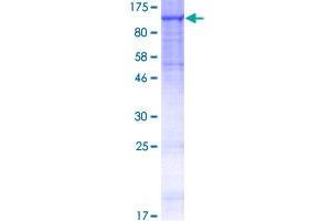 Image no. 1 for Mannosidase, beta A, Lysosomal (MANBA) (AA 1-879) protein (GST tag) (ABIN1310143)