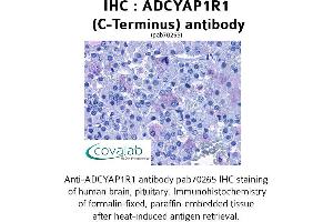 Image no. 1 for anti-Adenylate Cyclase Activating Polypeptide 1 (Pituitary) Receptor Type I (ADCYAP1R1) (C-Term) antibody (ABIN1731539)