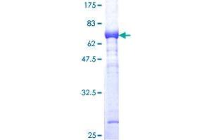 Aldolase C, Fructose-Bisphosphate (ALDOC) (AA 1-364) protein (GST tag)
