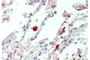 Rabbit Anti-Wnt11 antibody  Formalin Fixed Paraffin Embedded Tissue: Human Lung Primary antibody Concentration: 1:100 Secondary Antibody: Donkey anti-Rabbit-Cy3 Secondary Antibody Concentration: 1:200 Magnification: 20x Exposure Time: 0.