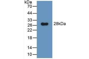 Detection of Recombinant GluAP, Rat using Polyclonal Antibody to Aminopeptidase A (ENPEP) (ENPEP anticorps  (AA 409-624))