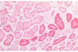 Detection of NAGLU in Human Kidney Tissue using Polyclonal Antibody to N-Acetyl Alpha-D-Glucosaminidase (NAGLU)
