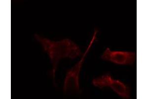 ABIN6274242 staining HepG2 cells by IF/ICC. (ADRBK2 anticorps  (Internal Region))