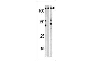 Western blot analysis of anti-CSE1L Pab (ABIN1882070 and ABIN2838356) in, from left to right, , CEM, and mouse heart cell line lysates (35 μg/lane). (CSE1L anticorps  (N-Term))