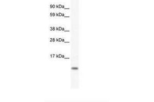 Image no. 1 for anti-FXYD Domain Containing Ion Transport Regulator 5 (FXYD5) (AA 54-103) antibody (ABIN307427) (FXYD5 anticorps  (AA 54-103))