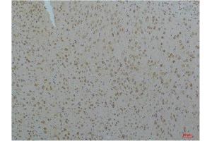 Immunohistochemistry (IHC) analysis of paraffin-embedded Mouse Brain Tissue using Cav pan alpha1 Rabbit Polyclonal Antibody diluted at 1:200. (Cav Pan Alpha1 (pan) anticorps)