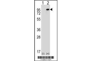 Western blot analysis of WHSC1L1 using rabbit polyclonal WHSC1L1 Antibody using 293 cell lysates (2 ug/lane) either nontransfected (Lane 1) or transiently transfected (Lane 2) with the WHSC1L1 gene. (WHSC1L1 anticorps  (N-Term))