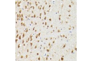 Immunohistochemistry of paraffin-embedded rat brain using PSM Rabbit pAb (ABIN3021834, ABIN3021835, ABIN3021836 and ABIN6216081) at dilution of 1:100 (40x lens). (PSMA3 anticorps  (AA 1-255))