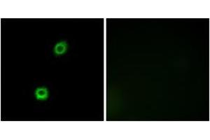Immunofluorescence (IF) image for anti-Myristoylated Alanine-Rich Protein Kinase C Substrate (MARCKS) (AA 126-175) antibody (ABIN2889023) (MARCKS anticorps  (AA 126-175))