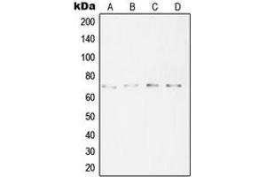 Western blot analysis of SYT16 expression in A431 (A), HeLa (B), A2058 (C), Jurkat (D) whole cell lysates. (SYT16 anticorps  (Center))