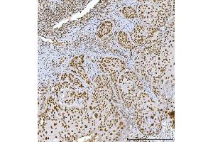 IHC analysis of RCC1 using anti-RCC1 antibody (ABIN7600022). (RCC1 anticorps  (AA 14-421))