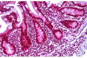Anti-TARBP2 antibody IHC staining of human small intestine. (TARBP2 anticorps)
