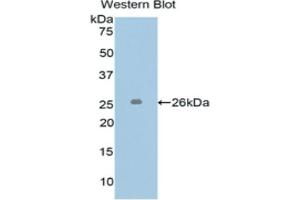 WB of Protein Standard: different control antibodies against Highly purified E. (L1CAM Kit ELISA)