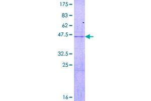 Image no. 1 for Ribosomal Protein L18 (RPL18) (AA 1-188) protein (GST tag) (ABIN1318558)