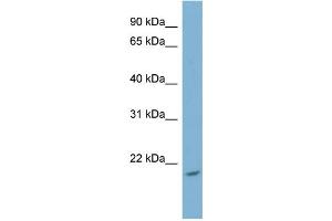 WB Suggested Anti-NME4 Antibody Titration: 0. (NME4 anticorps  (Middle Region))