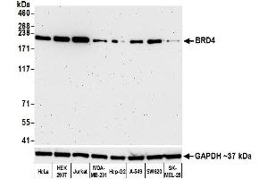 Western Blotting (WB) image for anti-Bromodomain Containing 4 (BRD4) (AA 1312-1362) antibody (ABIN7454041)