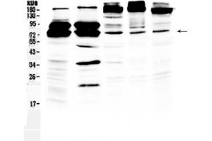 Western blot analysis of DDX3 using anti-DDX3 antibody .