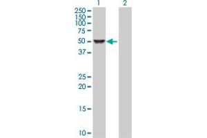 Western Blot analysis of CAMK4 expression in transfected 293T cell line by CAMK4 MaxPab polyclonal antibody. (CAMK4 anticorps  (AA 1-473))