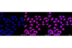 anti-AlkB, Alkylation Repair Homolog 1 (ALKBH1) antibody