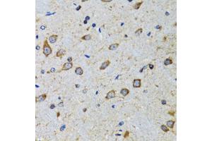 Immunohistochemistry of paraffin-embedded mouse brain using CDK1 antibody (ABIN5970051) at dilution of 1/100 (40x lens). (CDK1 anticorps  (Center))
