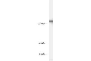 dilution: 1 : 1000, sample: rat hippocampus homogenate (CACNA1B anticorps  (alpha-1E subunit))
