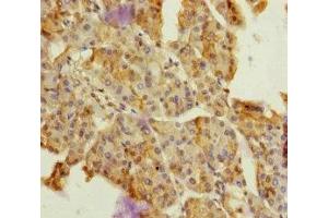 Immunohistochemistry of paraffin-embedded human pancreatic tissue using ABIN7149750 at dilution of 1:100
