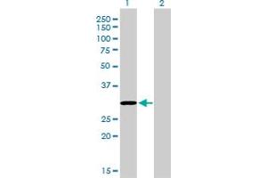 Western Blot analysis of COASY expression in transfected 293T cell line by COASY monoclonal antibody (M01), clone 1H6.