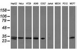Western blot analysis of extracts (35 µg) from 9 different cell lines by using anti-SPR monoclonal antibody. (SPR anticorps)