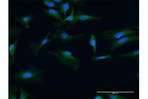 Immunofluorescence of purified MaxPab antibody to UBAC1 on HeLa cell. (UBAC1 anticorps  (AA 1-405))