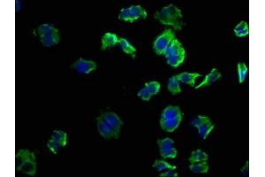 Immunofluorescence staining of PC-3 cells with ABIN7139863 at 1:50, counter-stained with DAPI.