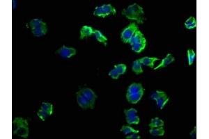 Immunofluorescence staining of PC-3 cells with ABIN7139863 at 1:50, counter-stained with DAPI. (GNG12 anticorps  (AA 2-17))