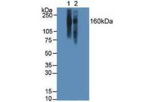 Western blot analysis of (1) Human Jurkat Cells and (2) Human Raji Cells. (ITGAL anticorps  (AA 809-1066))