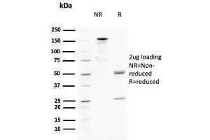 SDS-PAGE Analysis Purified AKT1 Mouse Monoclonal Antibody (AKT1/2784).