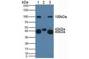 Figure. (CD161 anticorps  (AA 73-188))